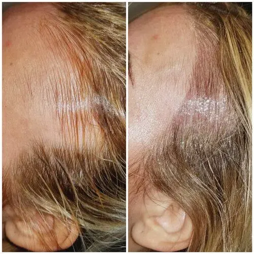 iBrow Vixen transformation result